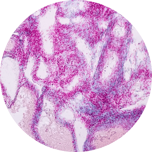 img-tissue